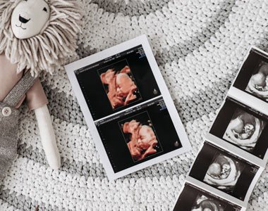 Antenatal-Care Antenatal-Care